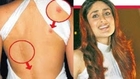 CHECK OUT | Kareena Kapoor Shows Off Her Love Bite On Back